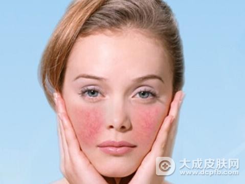 脸部皮肤过敏 小心护理进入误区