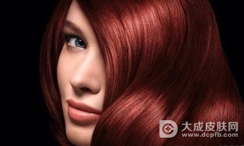 广州女生染发后过敏 头流黄液