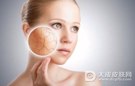 冬季皮肤干燥是怎么回事