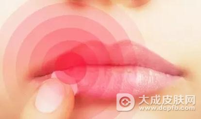 嘴唇上长泡竟是单纯疱疹