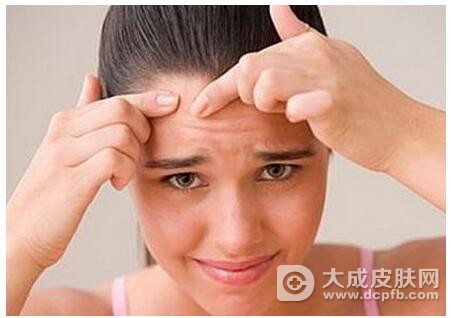 例假前爱长痘该怎么办