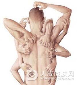 皮肤瘙痒该怎么办