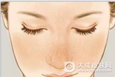 毛孔堵塞该怎么办