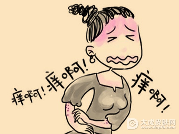 外阴瘙痒有哪些原因