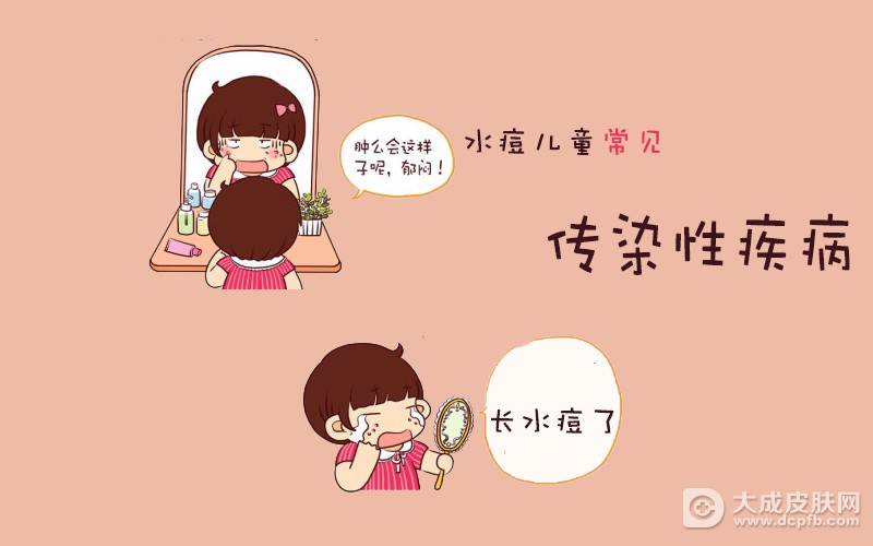 春季小心多发儿童水痘