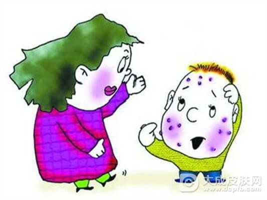 小儿水痘有哪些症状表现