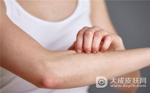 春季皮肤过敏有哪些原因