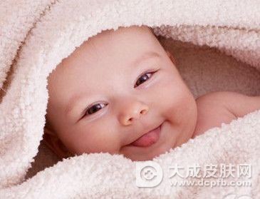 关于婴儿湿疹你了解多少
