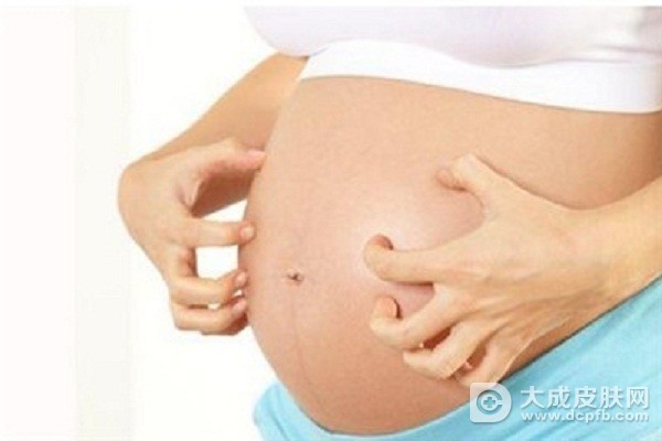 怀孕期间如何防止皮肤干燥