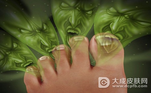 缓解脚臭的五大偏方