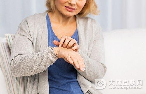 皮肤干燥导致瘙痒该怎么办