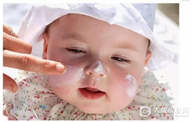预防宝宝湿疹的几点