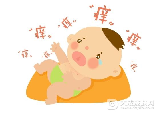 防治痱子 教你四个妙招