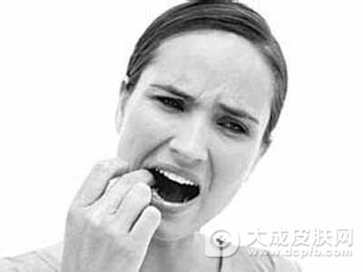 口腔溃疡是什么原因造成的