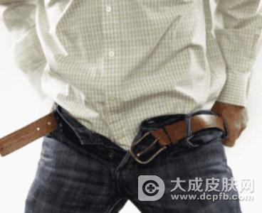 阴囊湿疹的症状以及怎么治