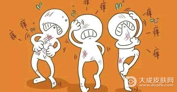 荨麻疹的忌口有什么