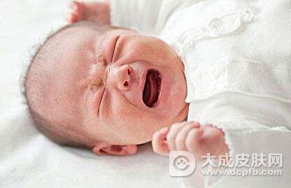 宝宝鹅口疮怎么办