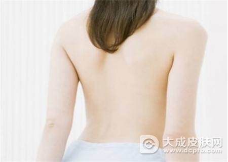 背上长痘了怎么办