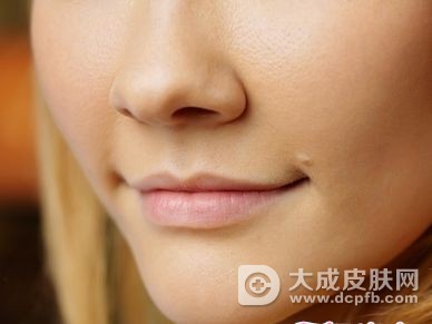 嘴巴周围长痘怎么办