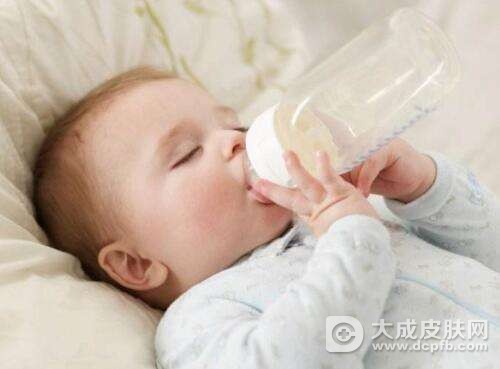 宝宝奶粉过敏的症状以及处理方法