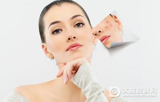 脸上的痘印怎么消除