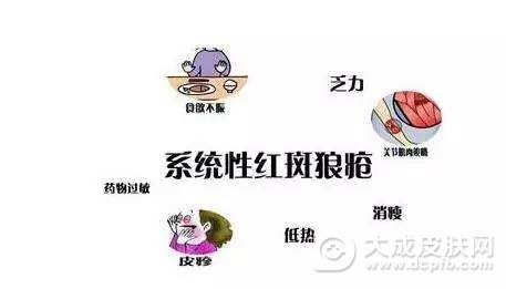 系统性红斑狼疮的病症是什么样的