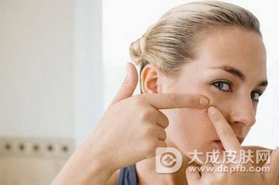 脸上不停的长粉刺什么原因