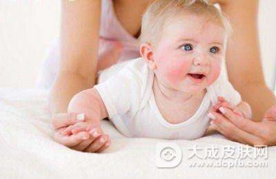 湿疹的护理小常识