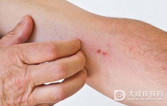 老年人皮肤瘙痒怎么回事