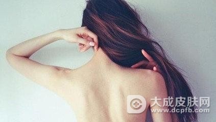 背部毛囊炎怎么治