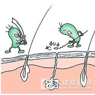 腋臭怎么治疗好的快