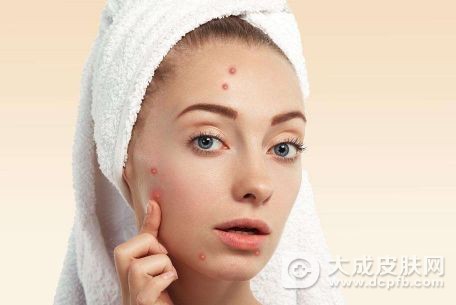 脸上的痘痘红肿很硬怎么办