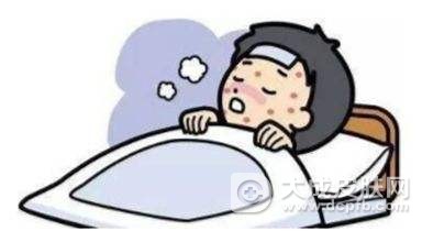带状疱疹的发病症状及治疗