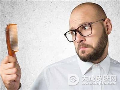 掉头发很厉害怎么改善