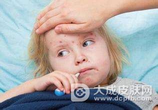 儿童荨麻疹的起因是什么
