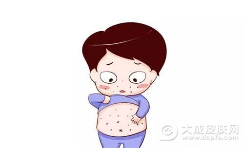 皮肤过敏用什么药
