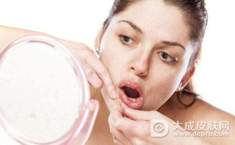 下巴长痘痘怎么进行调理
