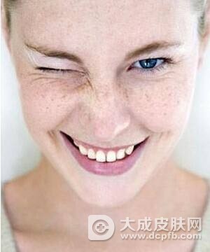 脸上长了晒斑怎么办
