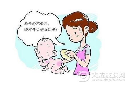 夏季的痱子怎么预防