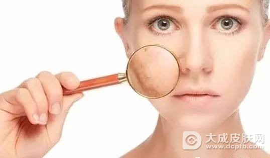 什么水果能够改善皮肤粗糙