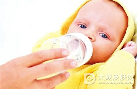 宝宝奶粉过敏怎么处理