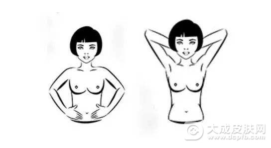 乳房湿疹的危害