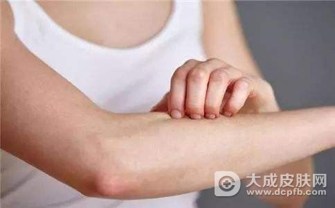 螨虫过敏有什么方法预防吗