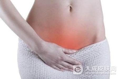 女性尖锐湿疣症状图片