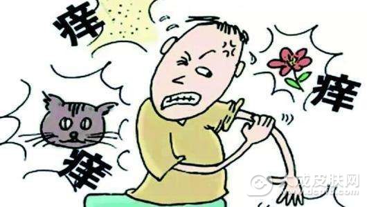 慢性荨麻疹的治疗
