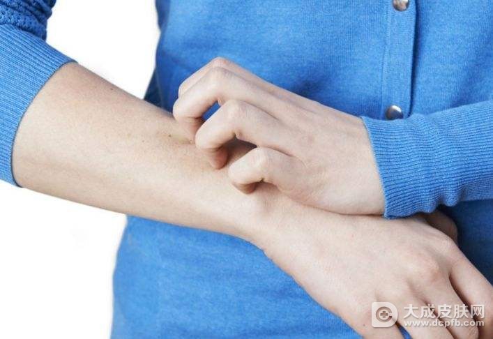 身上痒有可能是什么原因造成的