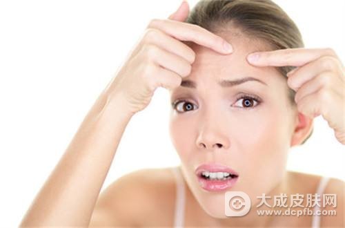 额头上长痘痘的原因