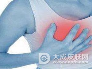 乳房湿疹的护理治疗
