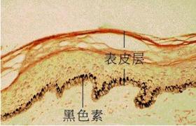 皮肤涂片显微镜检查