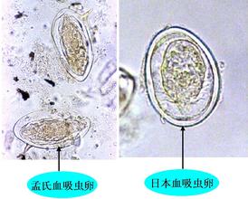 血吸虫环卵沉淀试验